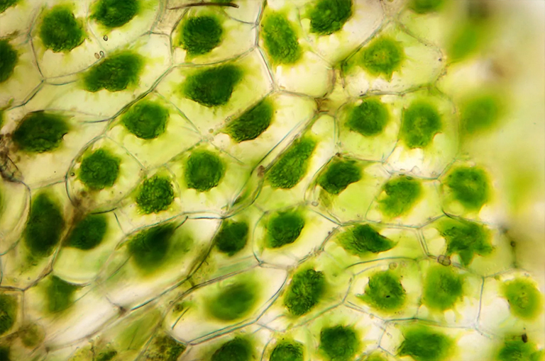 all細胞的光學顯微照片.jpg all細胞的光學顯微照片